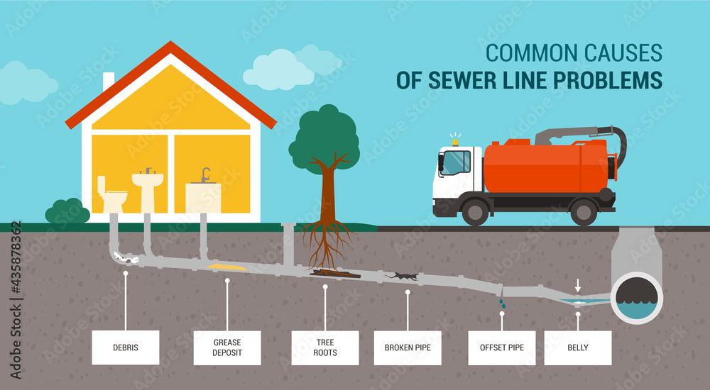 Drawing that shows common causes of sewer line problems.